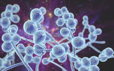 Chronic Candida Overgrowth: Causes and Effective Treatment
